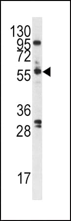 PLK1 / PLK-1 Antibody (aa573-603)