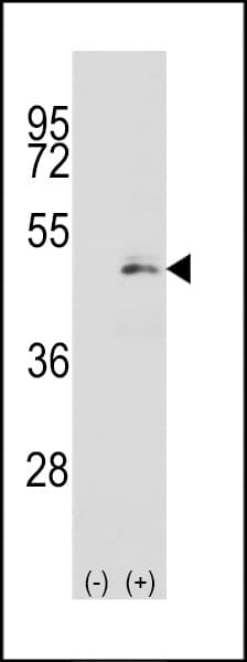Polyclonal Rabbit anti-Human MAP2K2 / MKK2 / MEK2 Antibody (Ser218, WB)