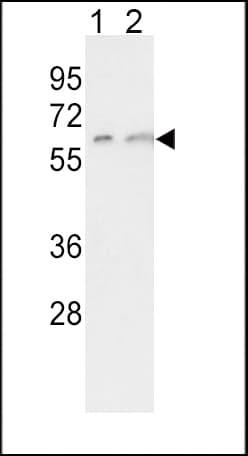 Polyclonal Rabbit anti-Human CYP7A1 Antibody (aa476-504, WB)