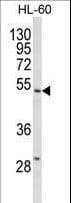 Polyclonal Rabbit anti-Human Selenium Binding Protein 1 Antibody (aa317-344, WB)