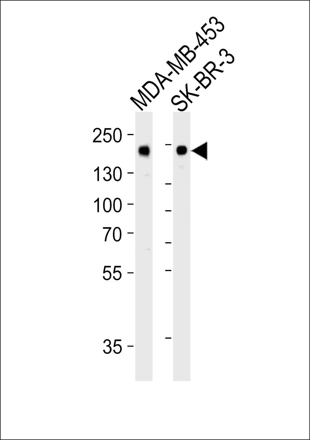 Monoclonal Mouse anti-Human ERBB2 / HER2 Antibody (clone 1423CT594.76.52, WB)