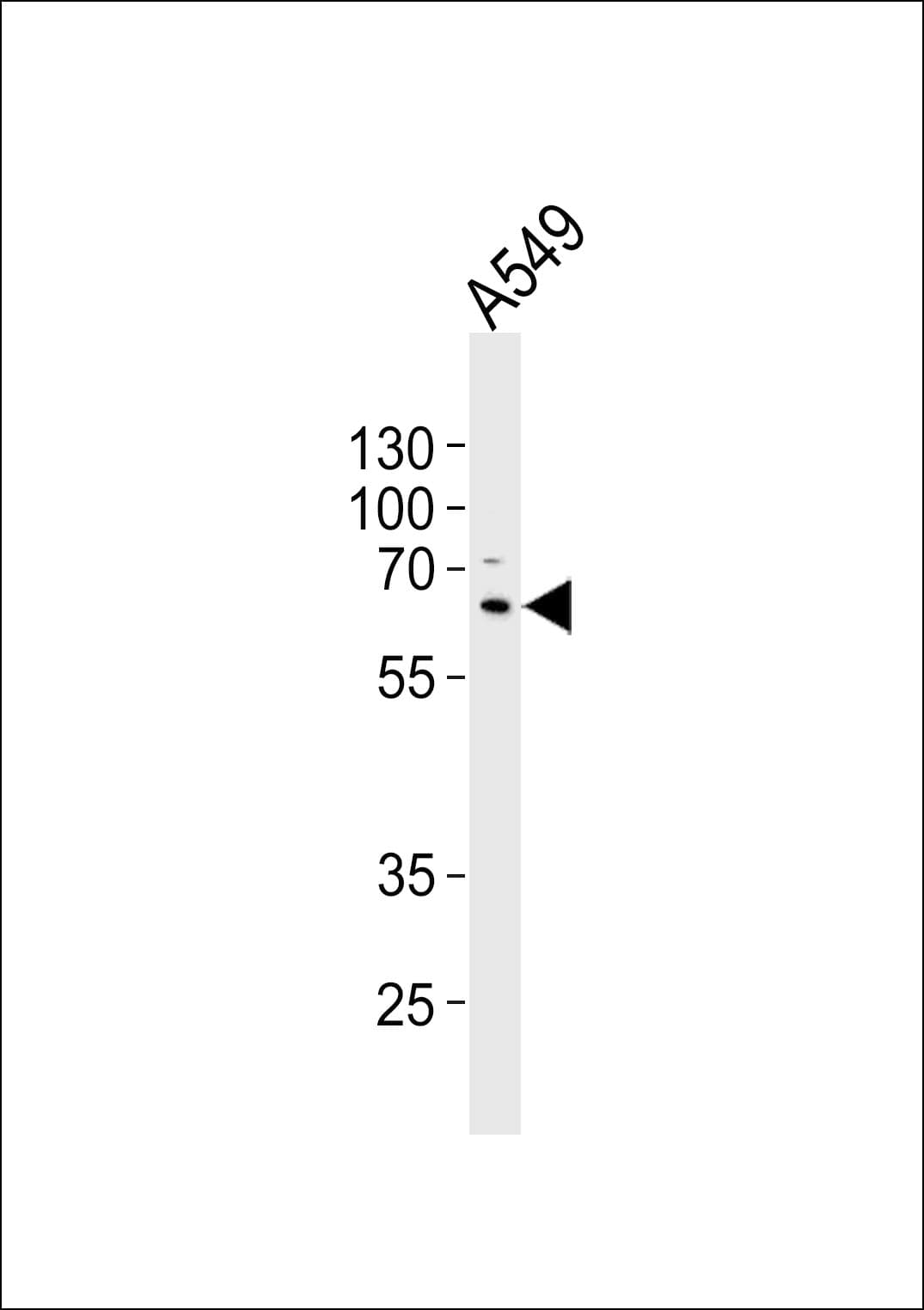 SQSTM1 Antibody (clone 1336CT763.152.125)