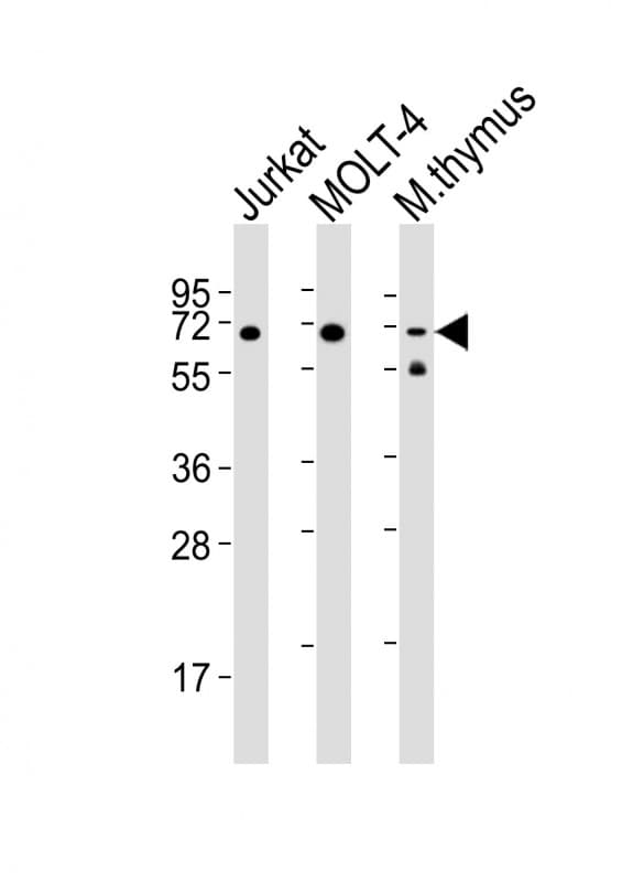 ZAP70 Antibody (clone 1484CT290.68.62)
