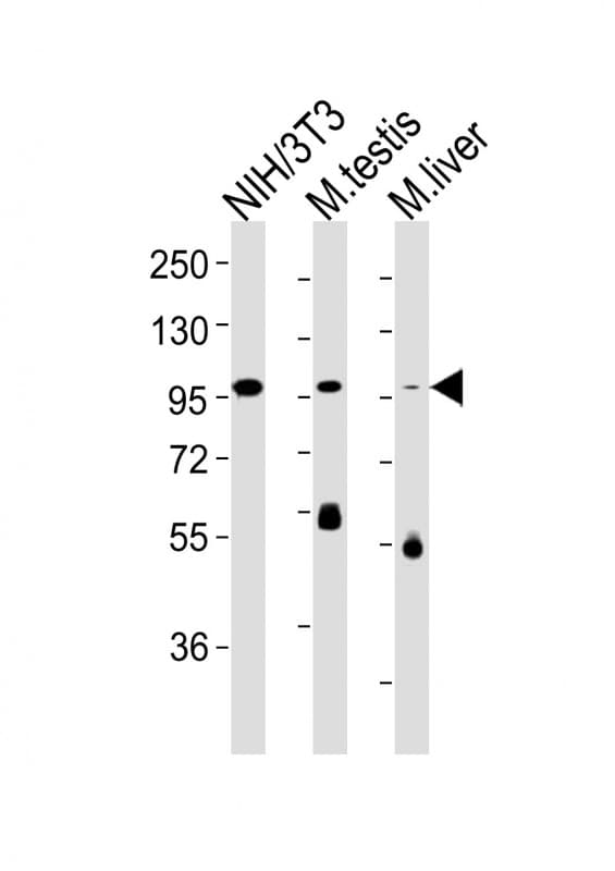 Monoclonal Mouse anti-Mouse FER Antibody (clone 1487CT794.8.50, WB)