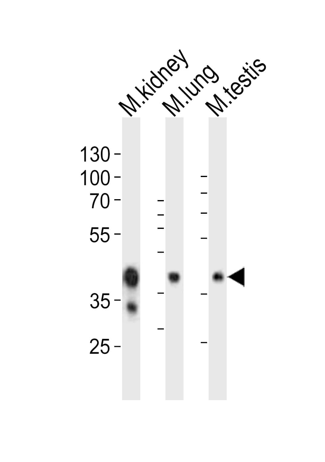 EPCAM Antibody (aa302-335)