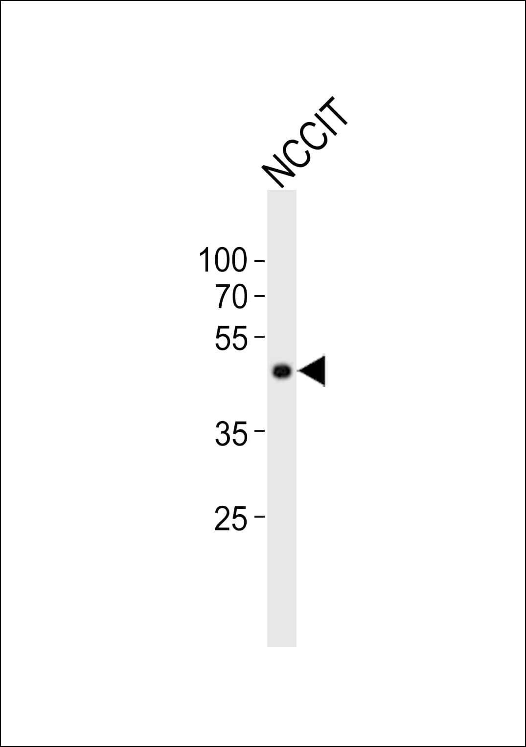 POU5F1 / OCT4 Antibody (aa123-157)