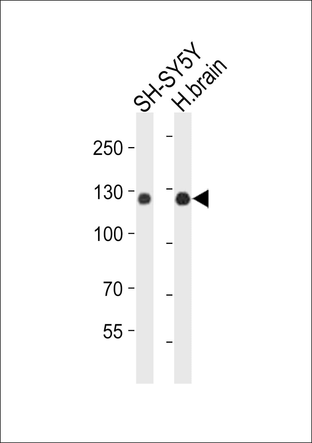 Polyclonal Rabbit anti-Human AMPH / Amphiphysin Antibody (aa580-614, WB)