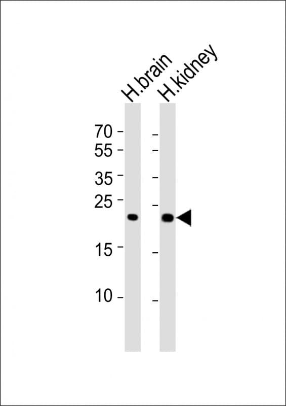 Polyclonal Rabbit anti-Human FGF9 Antibody (WB)