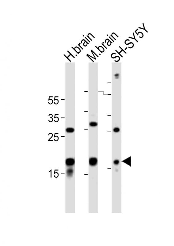 Polyclonal Rabbit anti-Human SCG10 / STMN2 Antibody (aa82-116, WB)