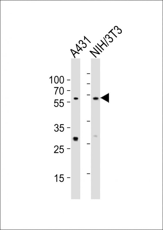 Polyclonal Rabbit anti-Mouse EED Antibody (aa269-303, WB)