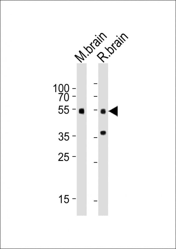 Polyclonal Rabbit anti-Mouse SMAD3 Antibody (aa188-222, WB)
