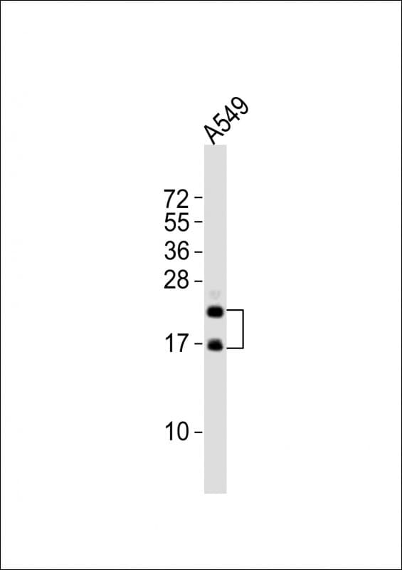 Polyclonal Rabbit anti-Human FGF2 / Basic FGF Antibody (WB)