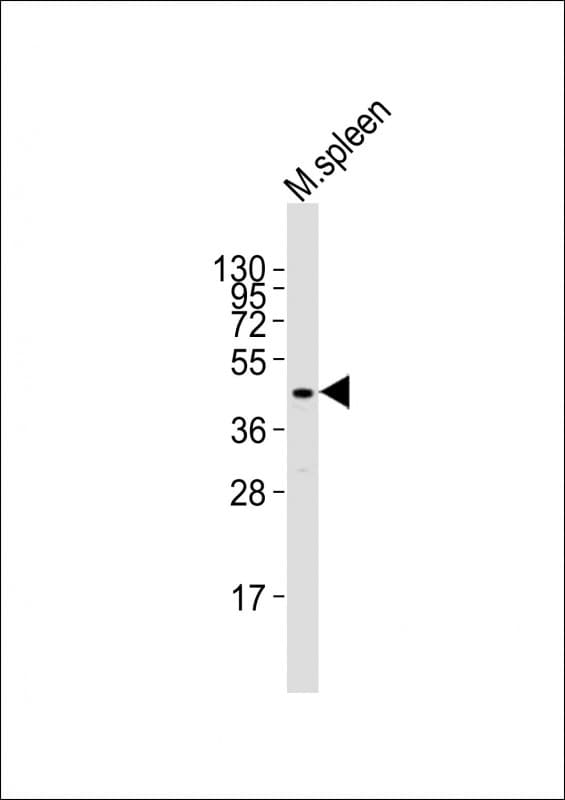 TAL1 Antibody (aa248-280)