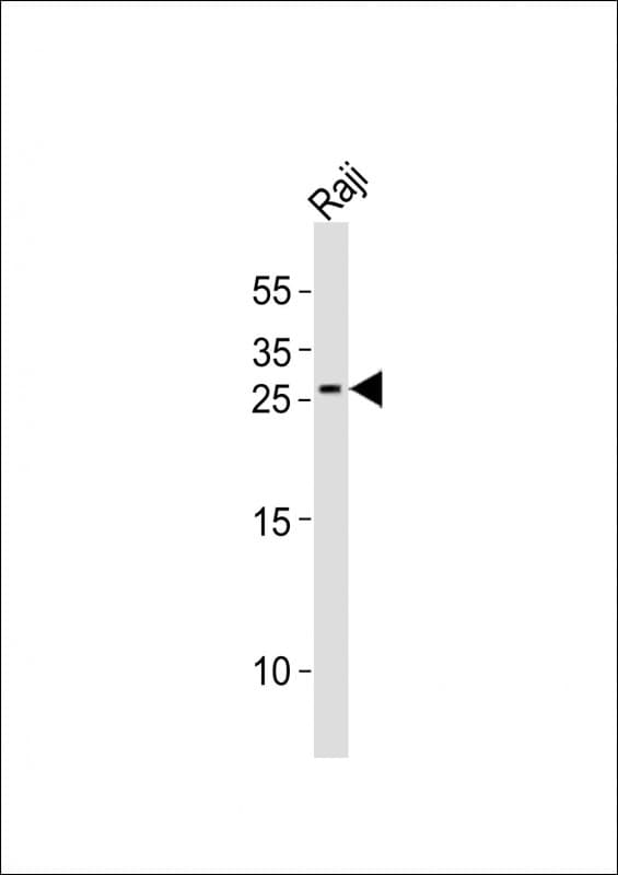 Polyclonal Rabbit anti-Human KITLG / SCF Antibody (aa201-234, WB)