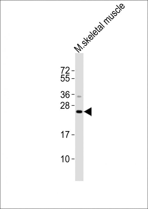 Polyclonal Rabbit anti-Mouse CTF1 / Cardiotrophin-1 Antibody (WB)