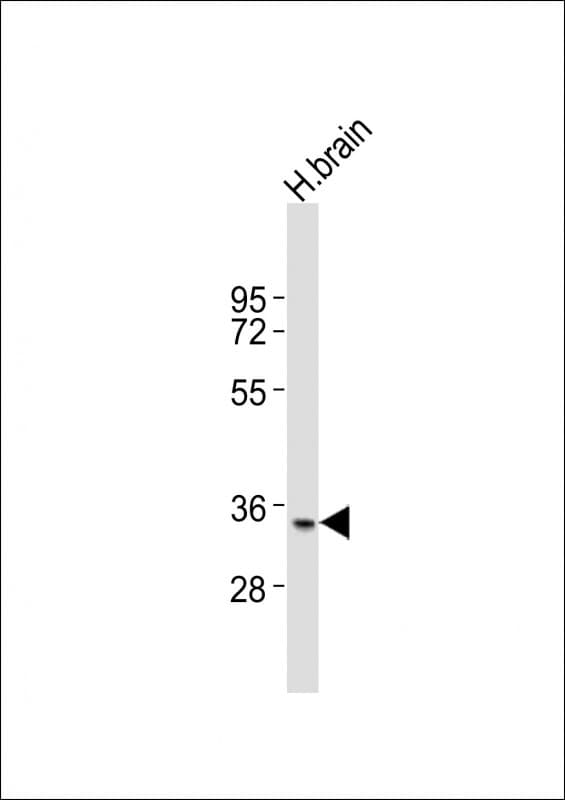Polyclonal Rabbit anti-Human NANOG Antibody (aa155-189, WB)