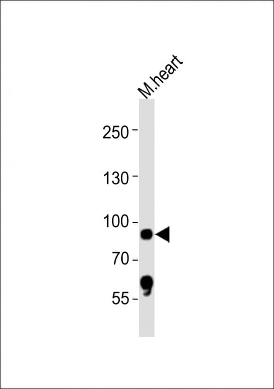 RPS6KA5 / MSK1 Antibody (aa780-815)
