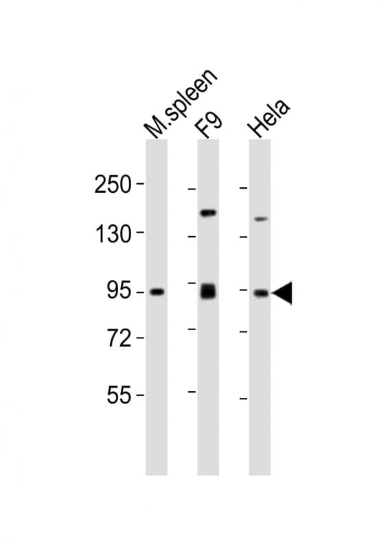 Polyclonal Rabbit anti-Human SUZ12 Antibody (aa375-408, WB)