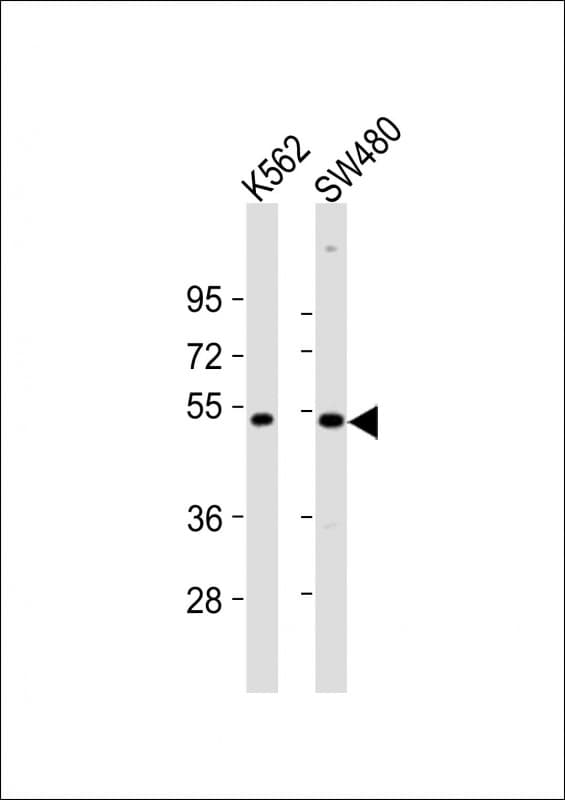 Polyclonal Rabbit anti-Human PRKAR2A Antibody (aa312-346, WB)