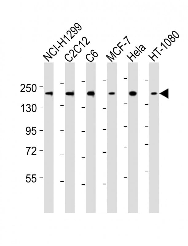 ROCK2 Antibody (aa1346-1380)