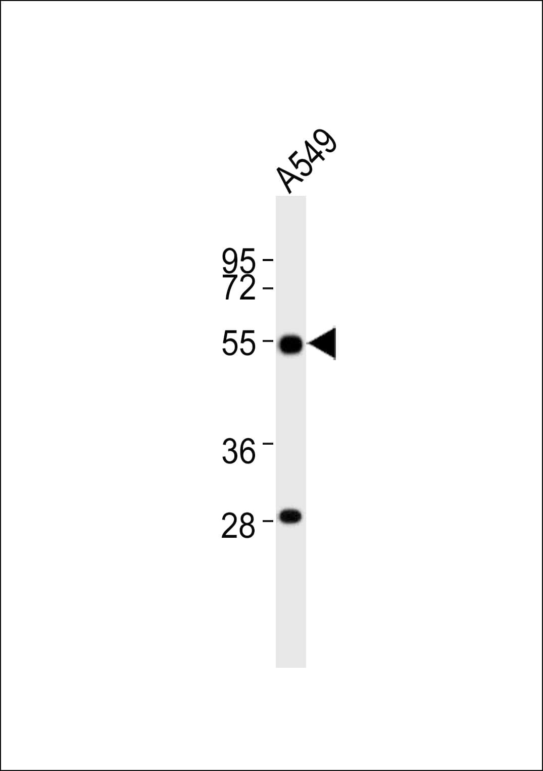 Polyclonal Rabbit anti-Human ALDH3A1 Antibody (WB)