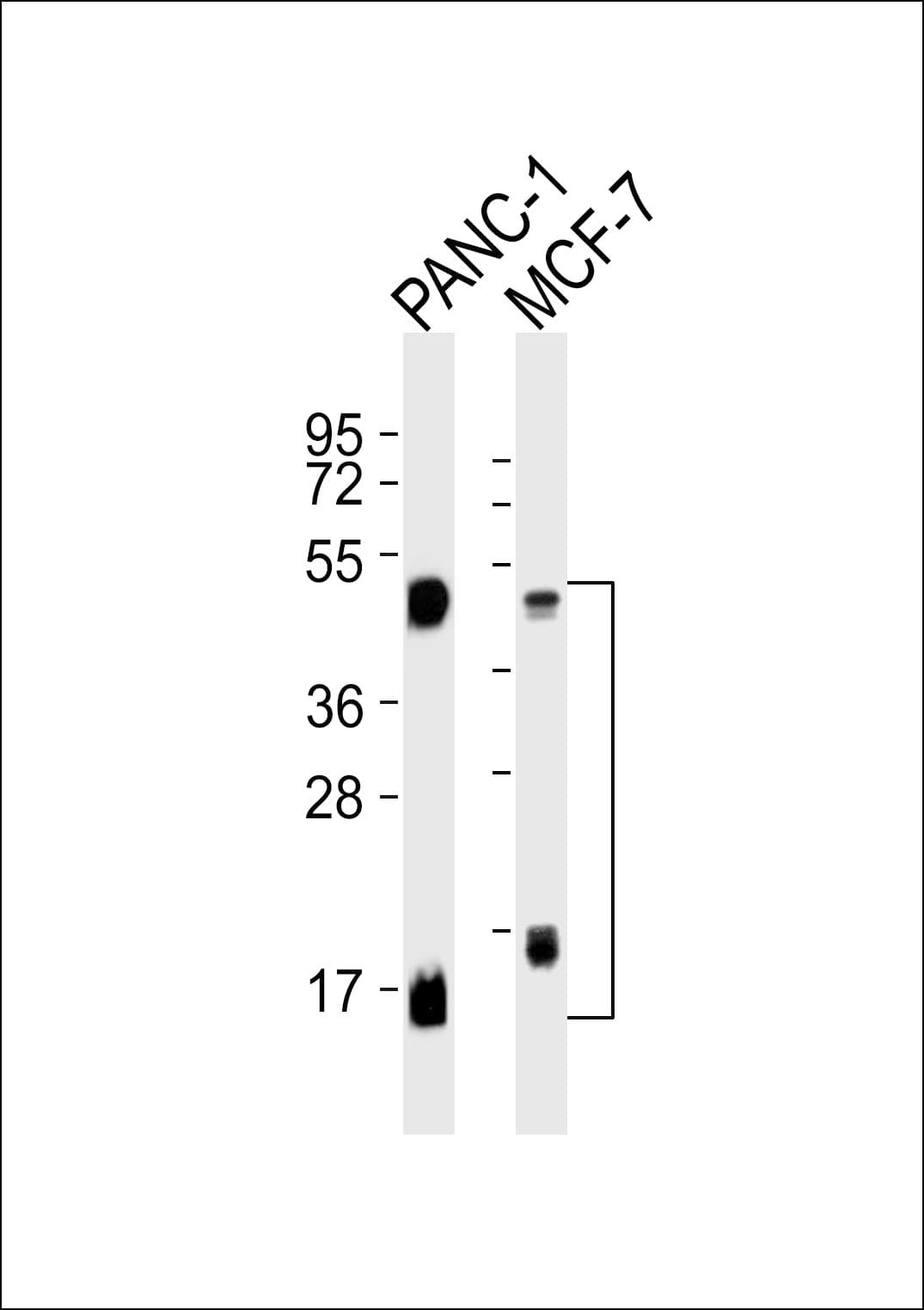 Polyclonal Rabbit anti-Human CTSD / Cathepsin D Antibody (WB)