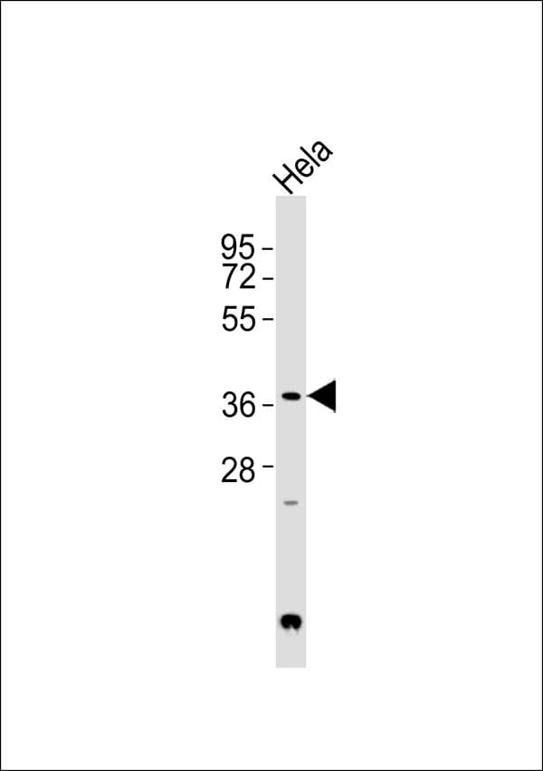 Polyclonal Rabbit anti-Human LGALS9 / Galectin 9 Antibody (WB)