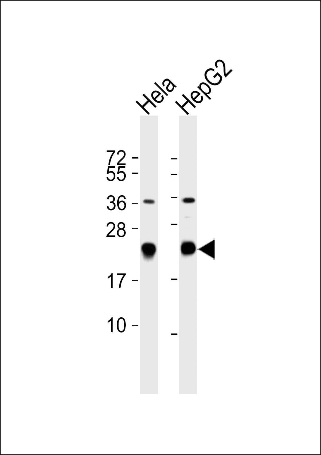 Polyclonal Rabbit anti-Human RPL17 / Ribosomal Protein L17 Antibody (WB)