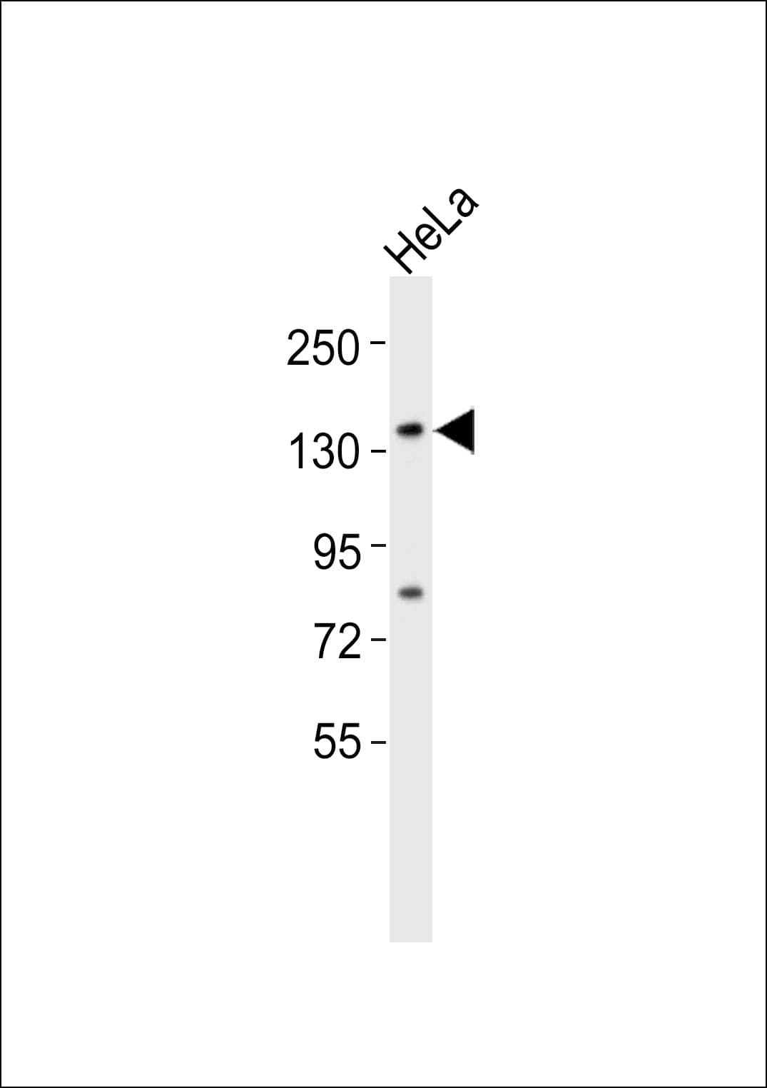 Polyclonal Rabbit anti-Human USP42 Antibody (WB)