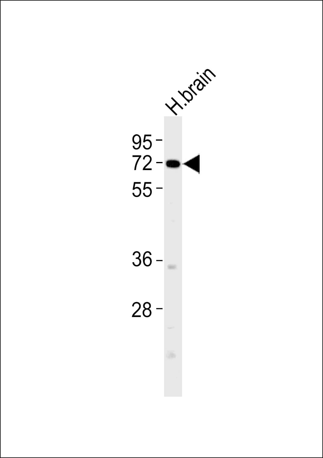 Polyclonal Rabbit anti-Human VGF Antibody (aa431-490, WB)