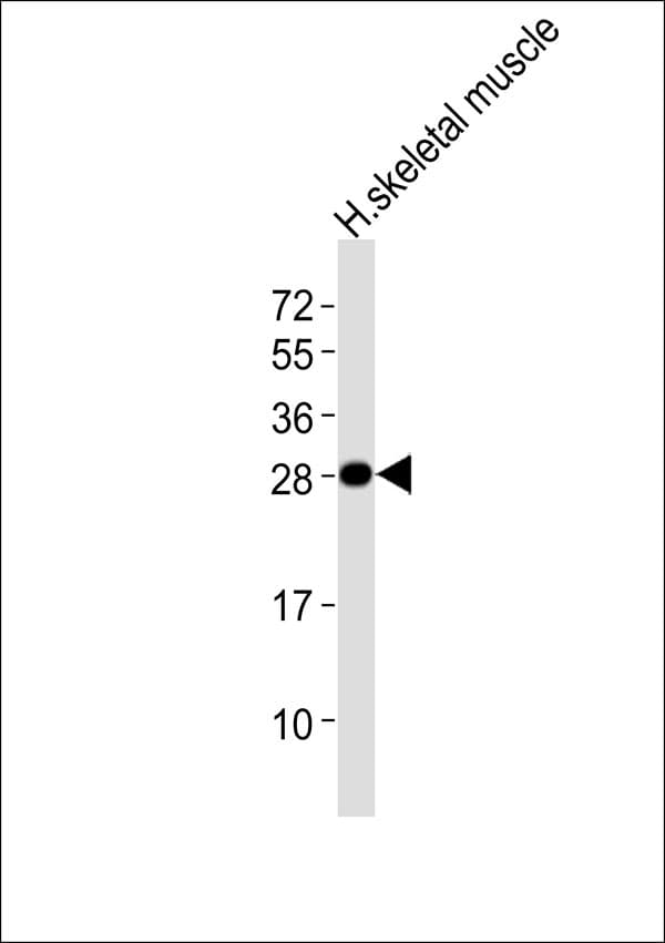 Polyclonal Rabbit anti-Human GSTM2 Antibody (WB)
