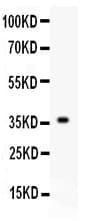 FGF1 / Acidic FGF Antibody (aa22-146)