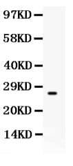 CD63 Antibody (aa97-238)