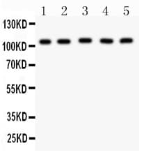 Polyclonal Rabbit anti-Human MSH2 Antibody (aa337-583, IHC, WB)
