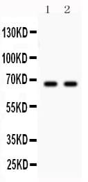 Polyclonal Rabbit anti-Human PARK2 / Parkin 2 Antibody (aa23-416, IHC, WB)