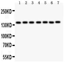 Polyclonal Rabbit anti-Human PARP1 Antibody (aa670-858, IHC, WB)