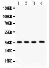 Polyclonal Rabbit anti-Human PBK / TOPK Antibody (aa71-322, IHC, WB)
