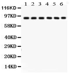 Polyclonal Rabbit anti-Human POU2F1 / OCT1 Antibody (aa11-240, IHC, WB)