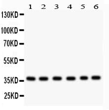 Polyclonal Rabbit anti-Human RAD51 / RECA Antibody (aa1-258, IHC, WB)