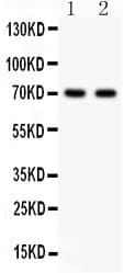 SHBG Antibody (aa30-210)