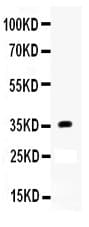 APOE / Apolipoprotein E Antibody (aa19-317)