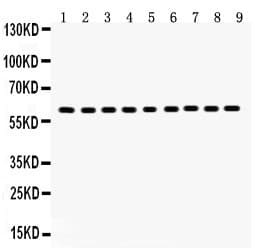 HSPD1 / HSP60 Antibody (aa260-496)