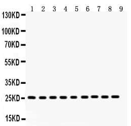 Polyclonal Rabbit anti-Human PRDX3 / Peroxiredoxin 3 Antibody (aa110-256, IHC, WB)