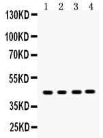 Polyclonal Rabbit anti-Human SERPINB5 / Maspin Antibody (aa1-350, IHC, WB)