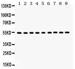 Polyclonal Rabbit anti-Human Vimentin Antibody (aa435-466, IHC, WB)