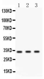 Polyclonal Rabbit anti-Human CCND1 / Cyclin D1 Antibody (aa158-184, WB)