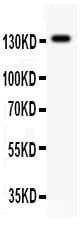 Polyclonal Rabbit anti-Human GRIN2C / NMDAR2C / NR2C Antibody (aa43-242, WB)