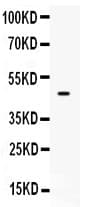 PTEN Antibody (aa91-403)