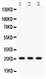 Polyclonal Rabbit anti-Human SFTPA1 + SFTPA2 Antibody (aa206-237, IHC, WB)