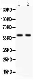 Polyclonal Rabbit anti-Human NCOA1 / SRC-1 Antibody (aa614-826, WB)